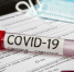 covid-19-covid-19_98862-738_1_h.jpg - Администрация г. Рубцовск